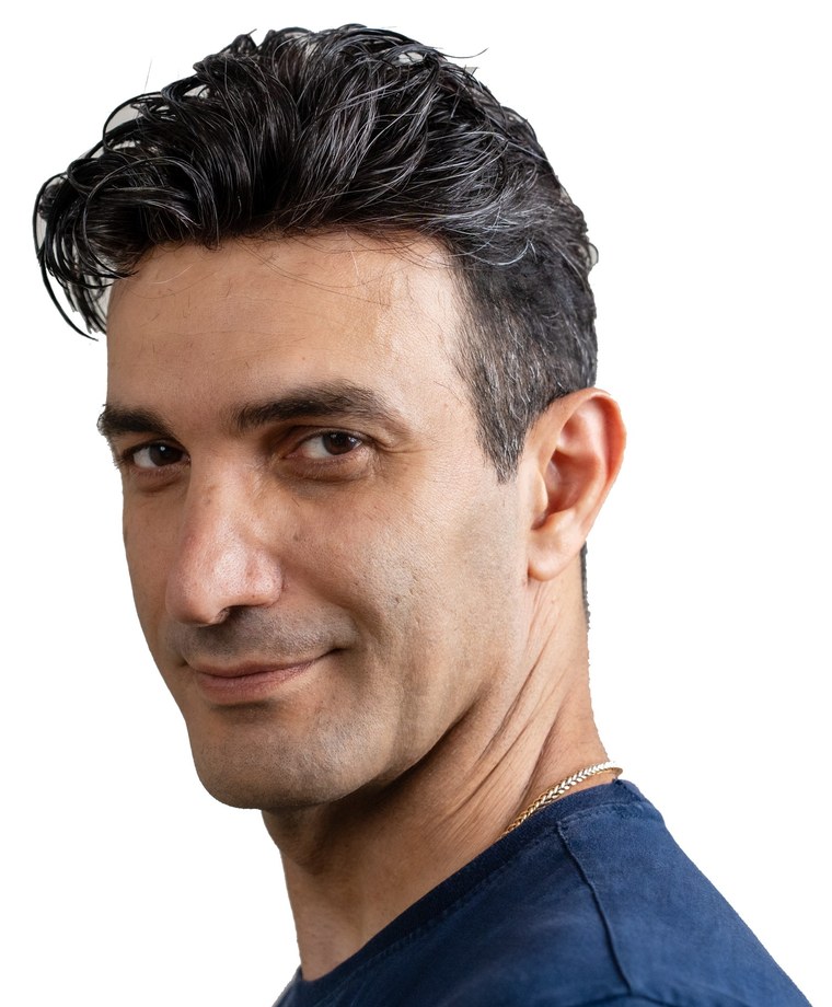 Berham after — natural-looking hair system fitted at Gen'C Hair Center