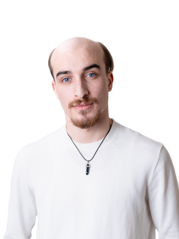 Bilal before — balding, before Gen'C hair system