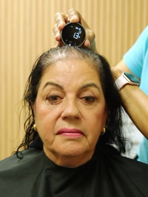 Asmaa before — thinning hair