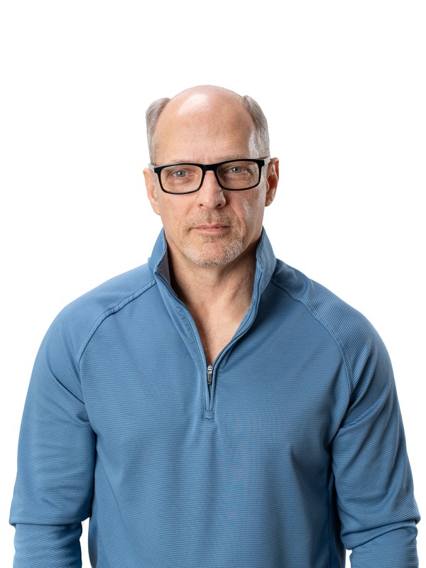Robert before — bald, before Gen'C hair system