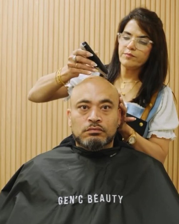Client before — hair system application at Gen'C Beauty