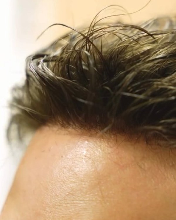 Hairline close-up — natural, seamless hairline at Gen'C Beauty